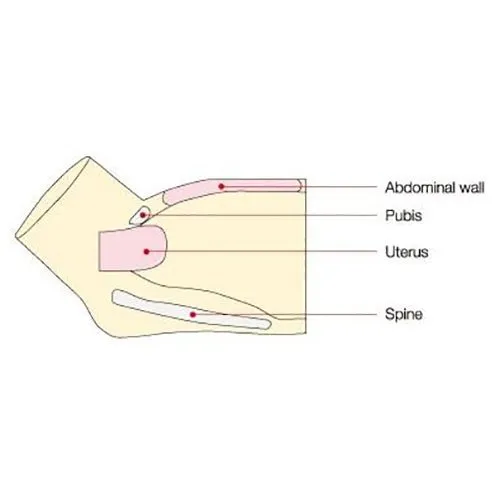 Koken Puerperal Uterus Palpation Training Model