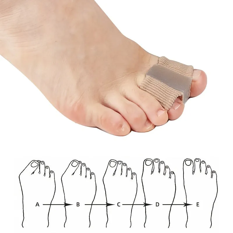 Thumb Valgus Orthosis Splitter Straighten Toes While You Sleep